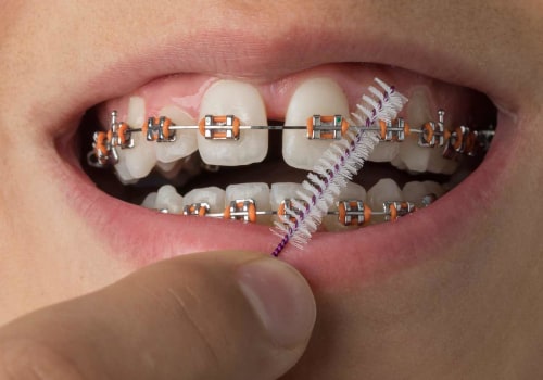 The Right Way to Use and Care for Braces and Supports