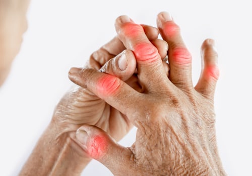 Understanding Arthritis: Symptoms and Diagnosis