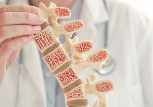 Understanding the Causes of Osteoporosis